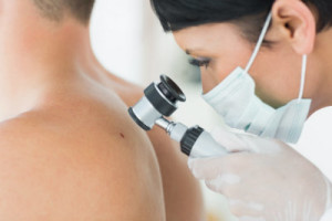 melanoma skin cancer in michigan city IN, at delaine md