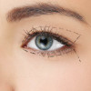 eyelid surgery