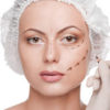 3 Tips for Making The Day of Surgery Easier plastic surgery